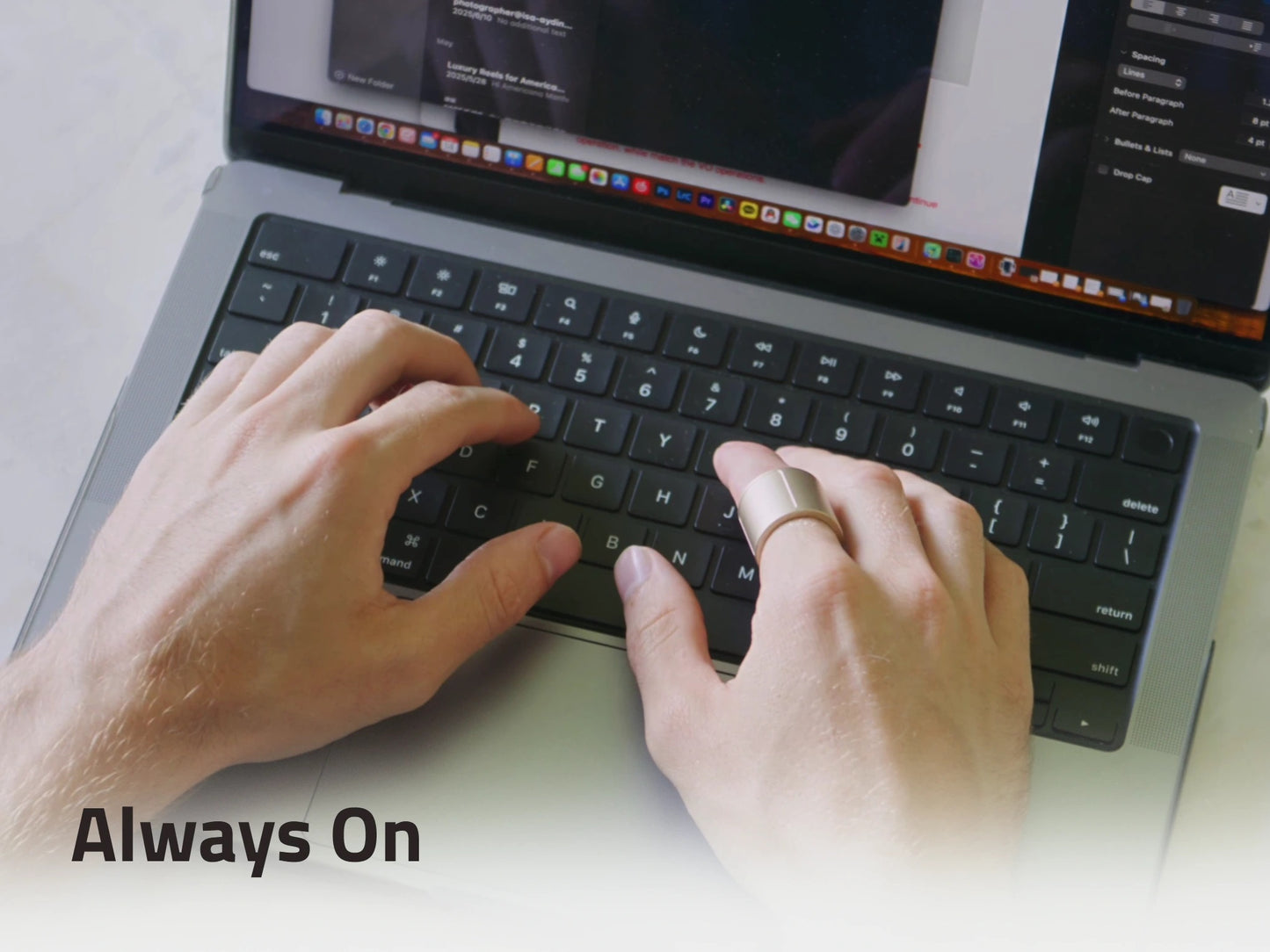 Prolo Ring – Basic Edition (Pre-Order)